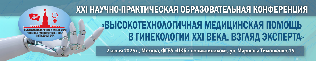 НМО